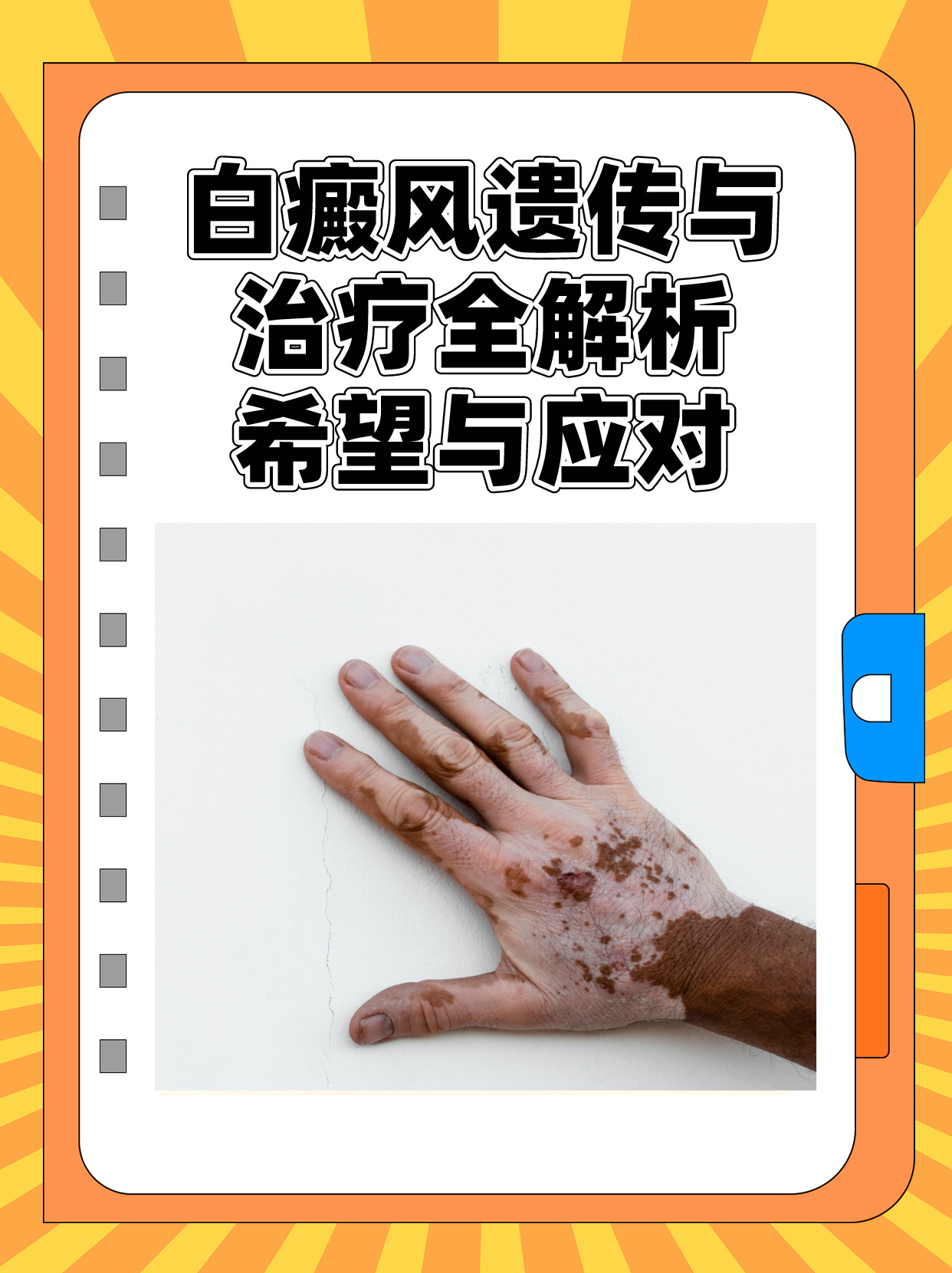 白斑病最新治療技術(shù)揭秘